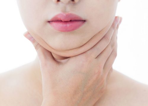Double Chin Causes and Treatments