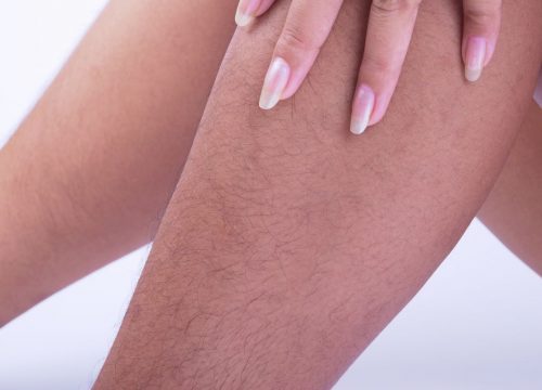 Unwanted Hair Causes and Treatments