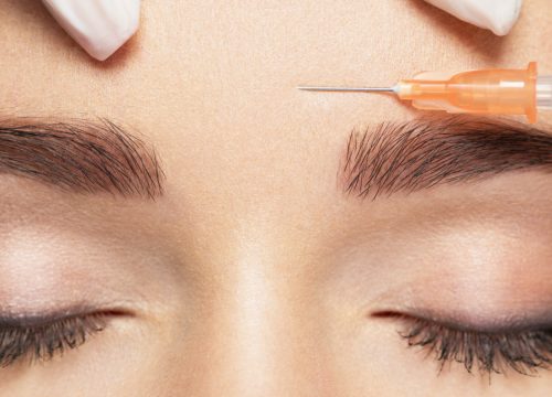 4 Safety Facts About BOTOX® Cosmetic