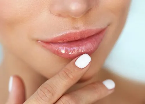 4 Dermal Filler Facts You Need to Know!