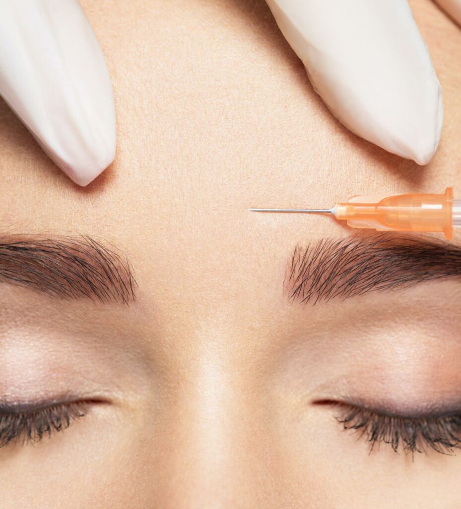 Closeup on a botox injection performed between the eyebrows