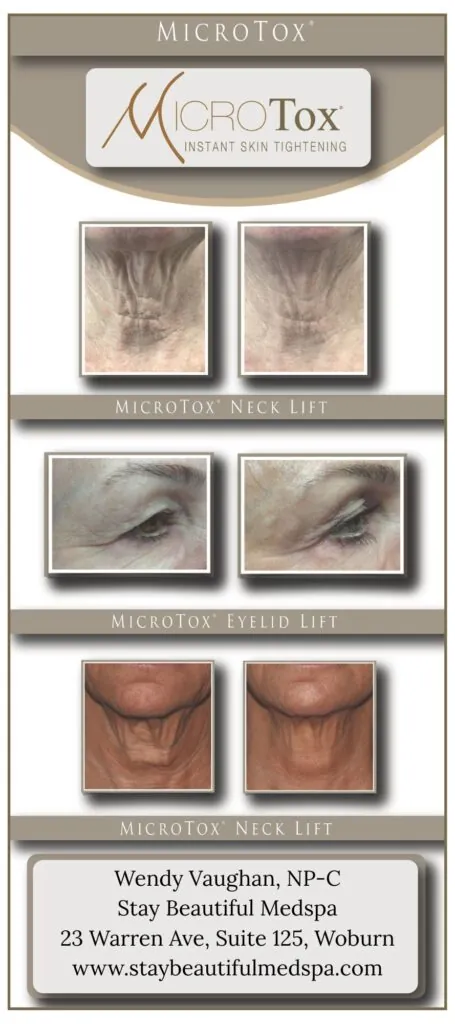 Before and after MicroTox® results
